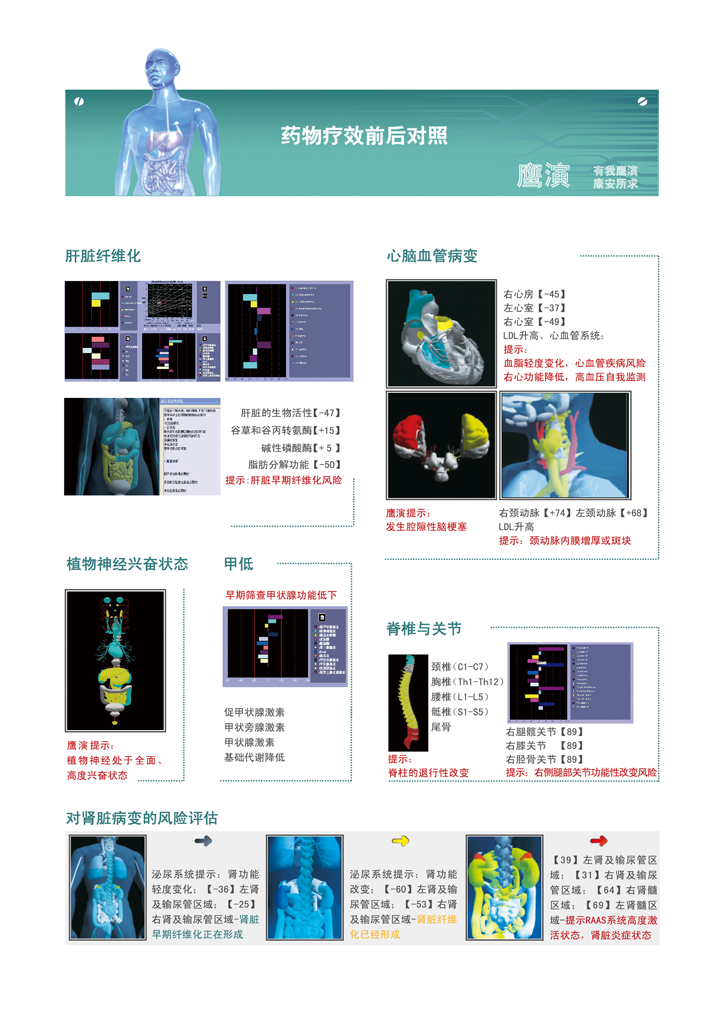 糖尿病早期無(wú)創(chuàng)檢測(cè)儀