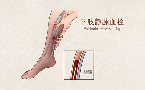 動脈硬化檢測儀