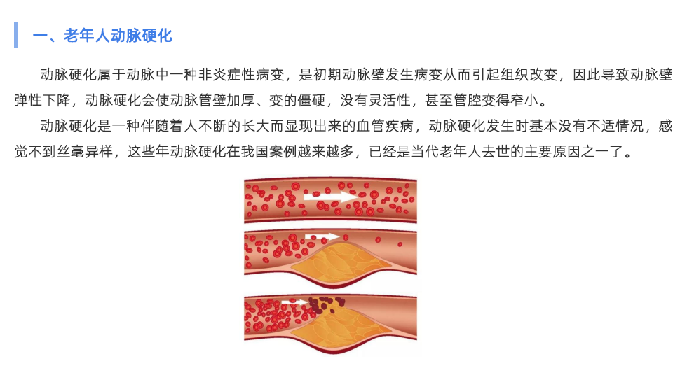 使用動脈硬化檢測儀