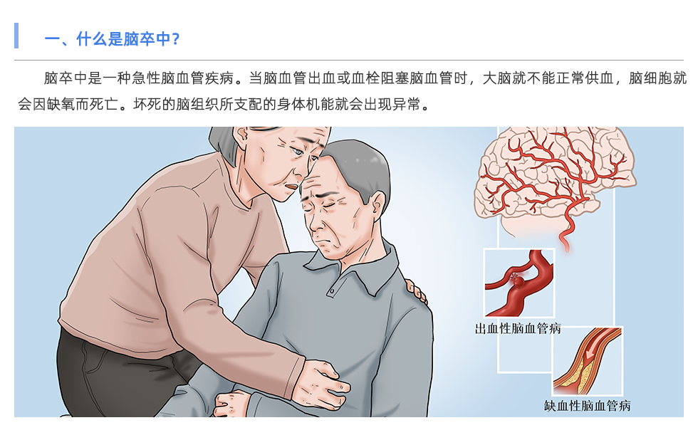動脈硬化檢測儀