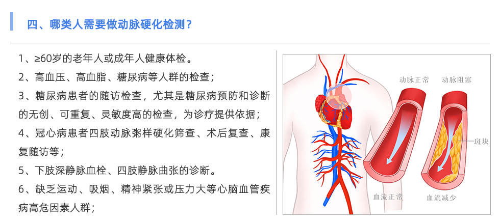 動脈硬化檢測儀