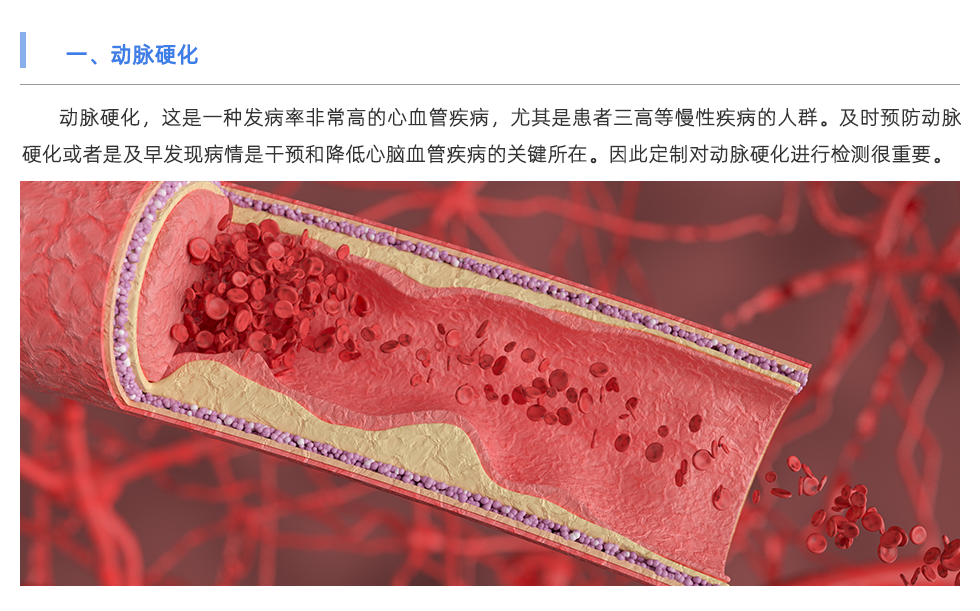 動脈硬化檢測儀