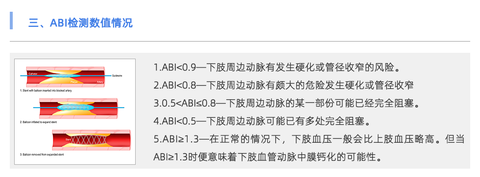 動脈硬化檢測儀