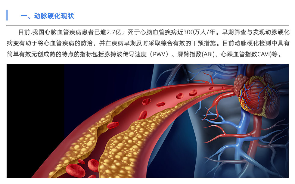 動(dòng)脈硬化檢測(cè)儀