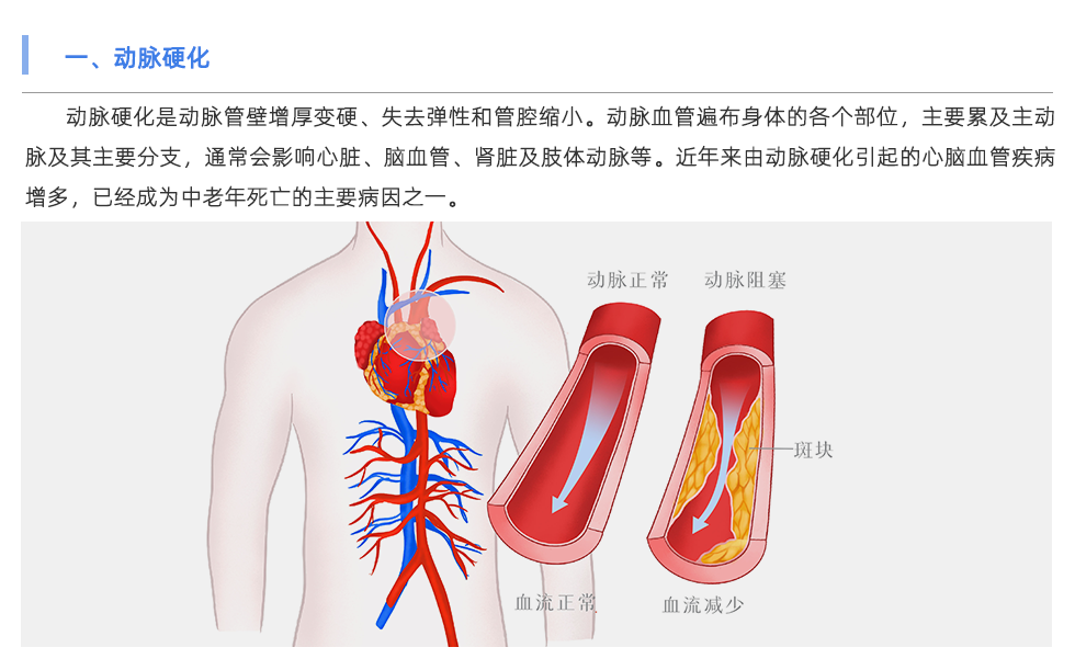 動(dòng)脈硬化檢測(cè)儀
