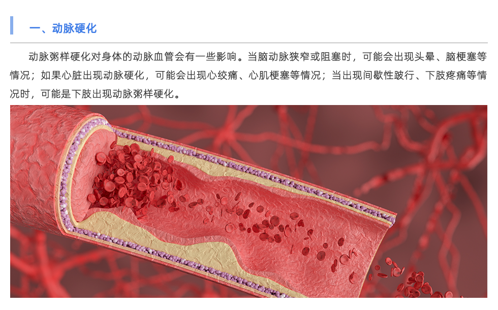 動(dòng)脈硬化檢測(cè)儀