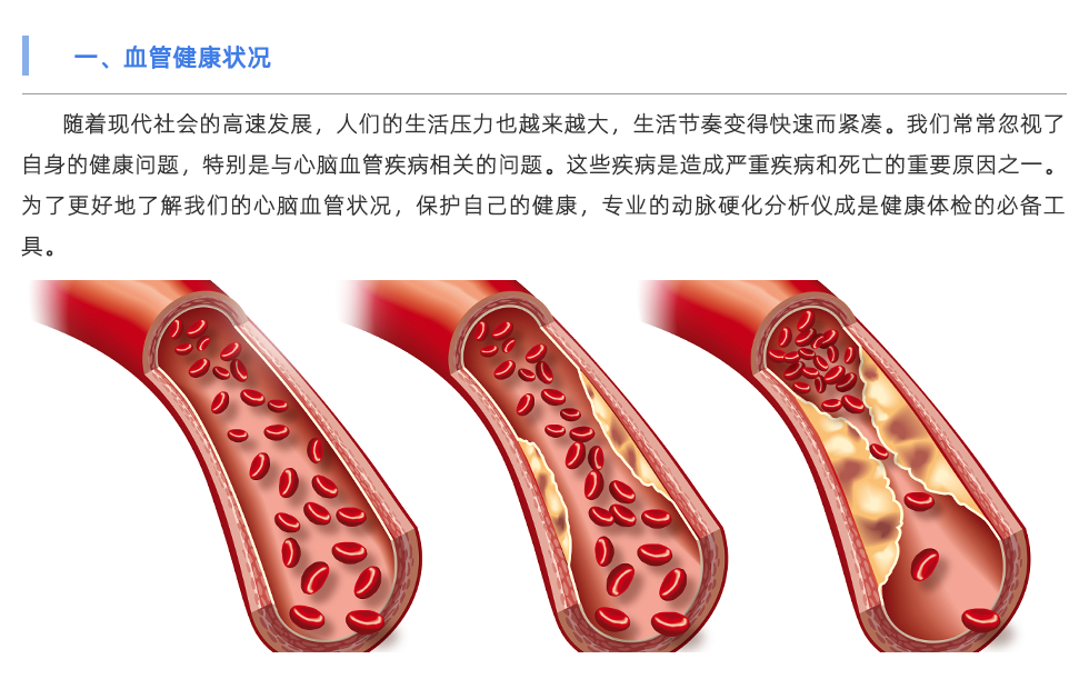 動(dòng)脈硬化分析儀