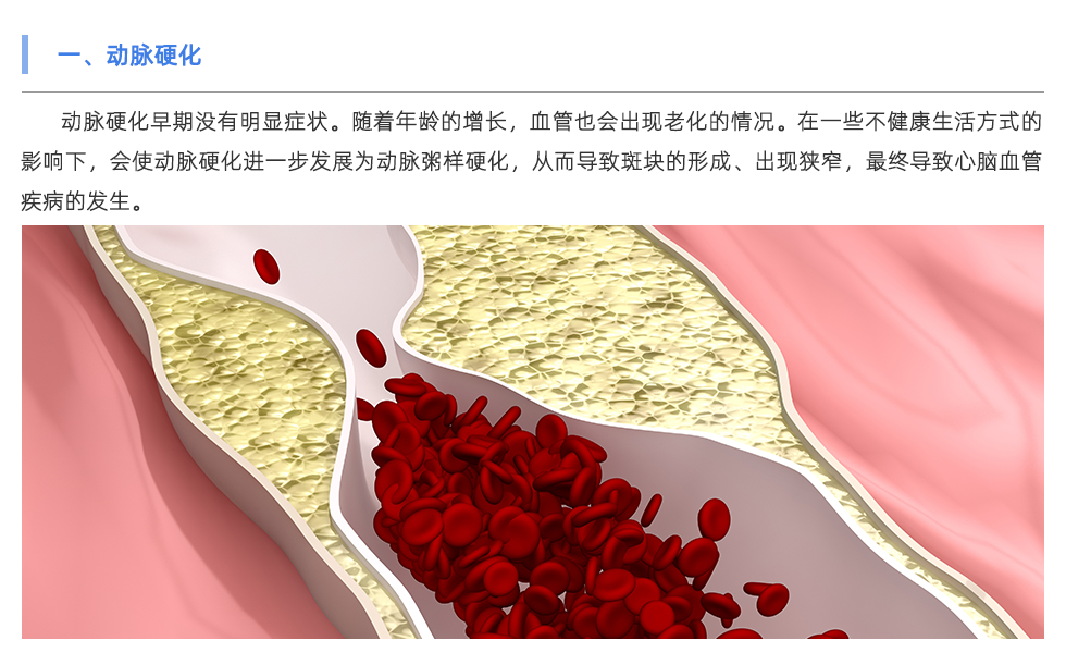 動(dòng)脈硬化分析儀