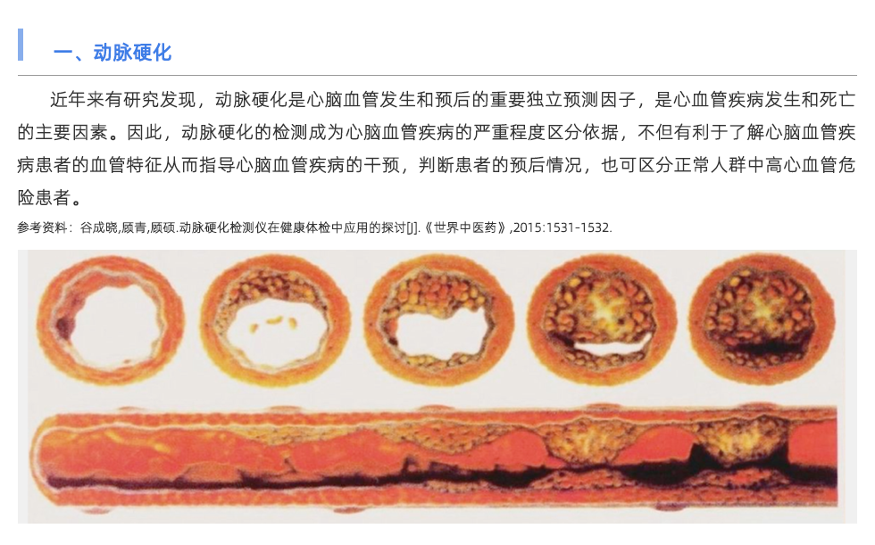 動(dòng)脈硬化檢測(cè)儀