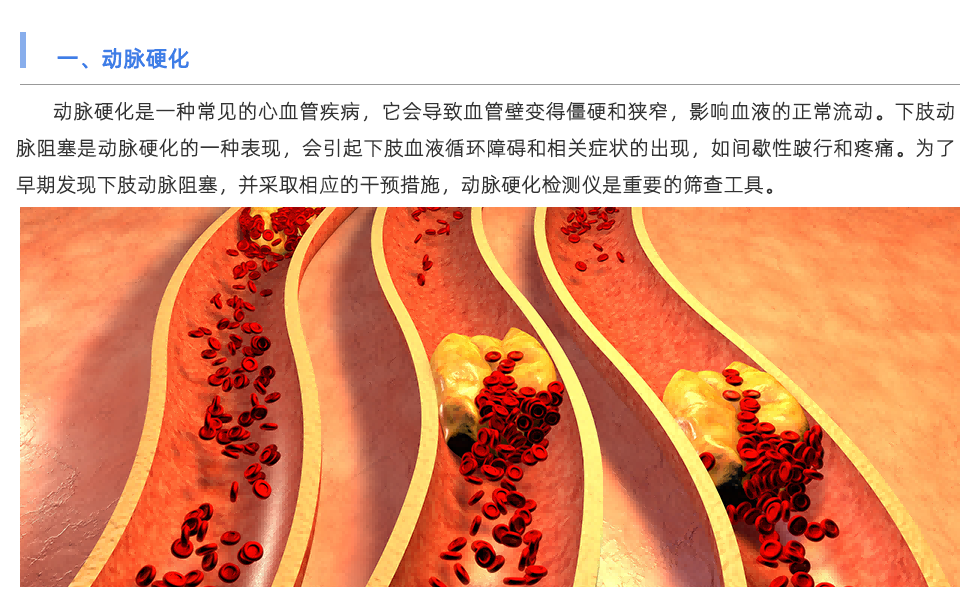 動脈硬化檢測儀