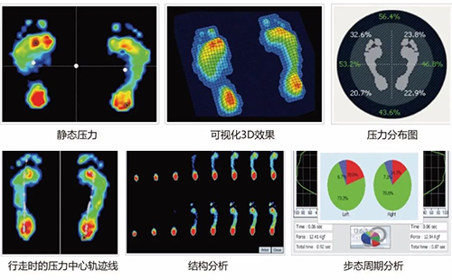 足底壓力檢測儀