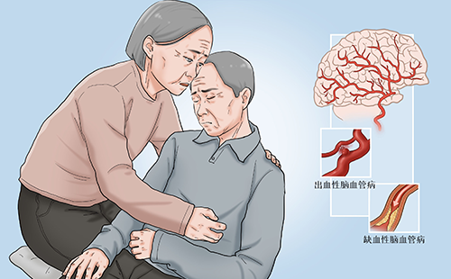 動(dòng)脈硬化檢測(cè)儀