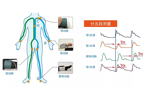 動(dòng)脈硬化分析儀