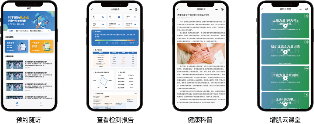 肌少癥數(shù)字化評估與干預(yù)系統(tǒng)